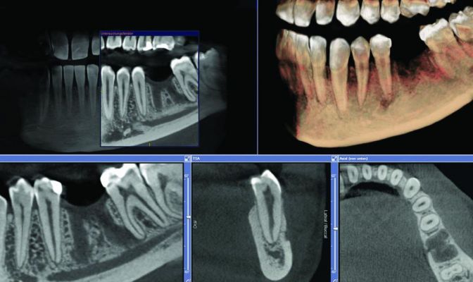 Click to enlarge image tac-denti.jpg